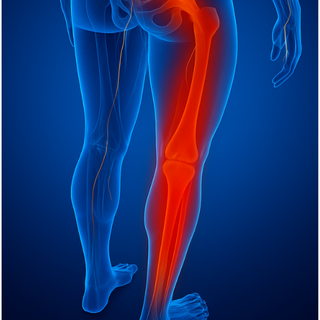 Jambes lourdes